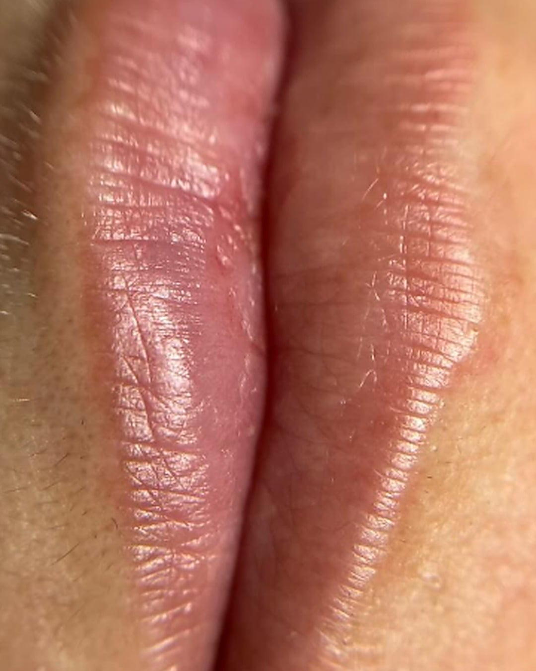 Doğal pembe dudak — Lip Blush — önce