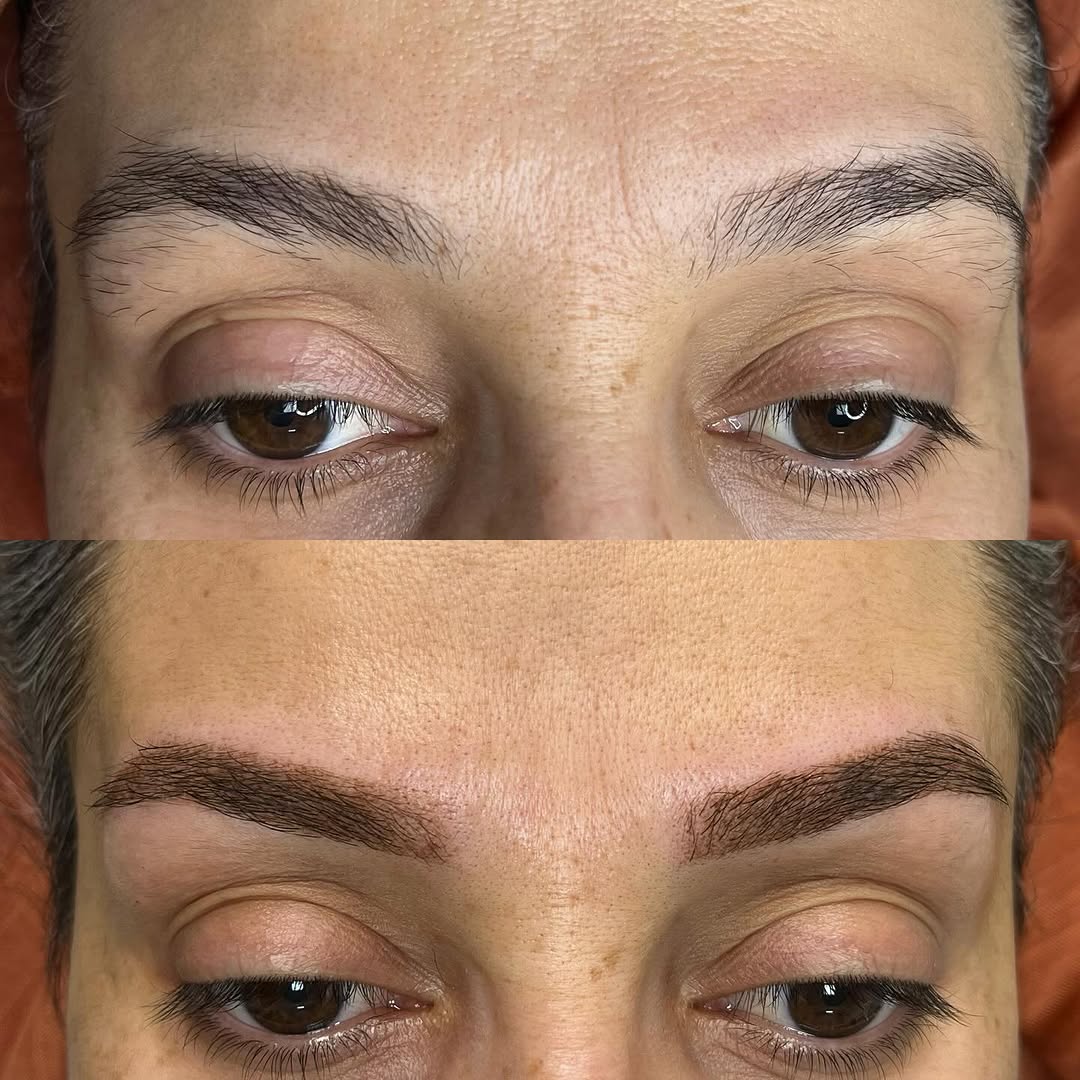 Microblading vs Powder Brows: Antalya Expert Compares