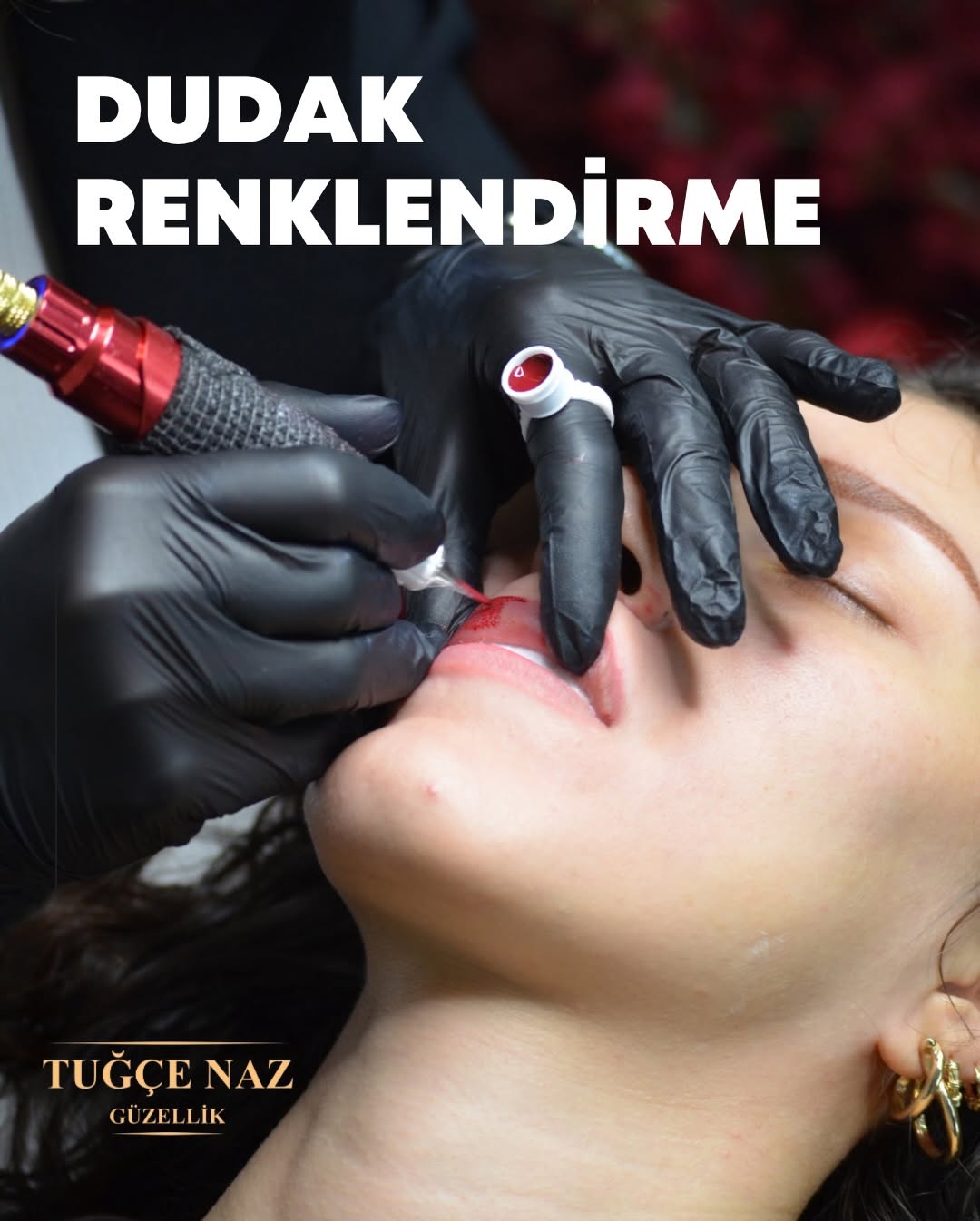 📞 0505 041 0707
Estetik bir işlem yalnızca görünümü değil, süreci de kapsar.
H
