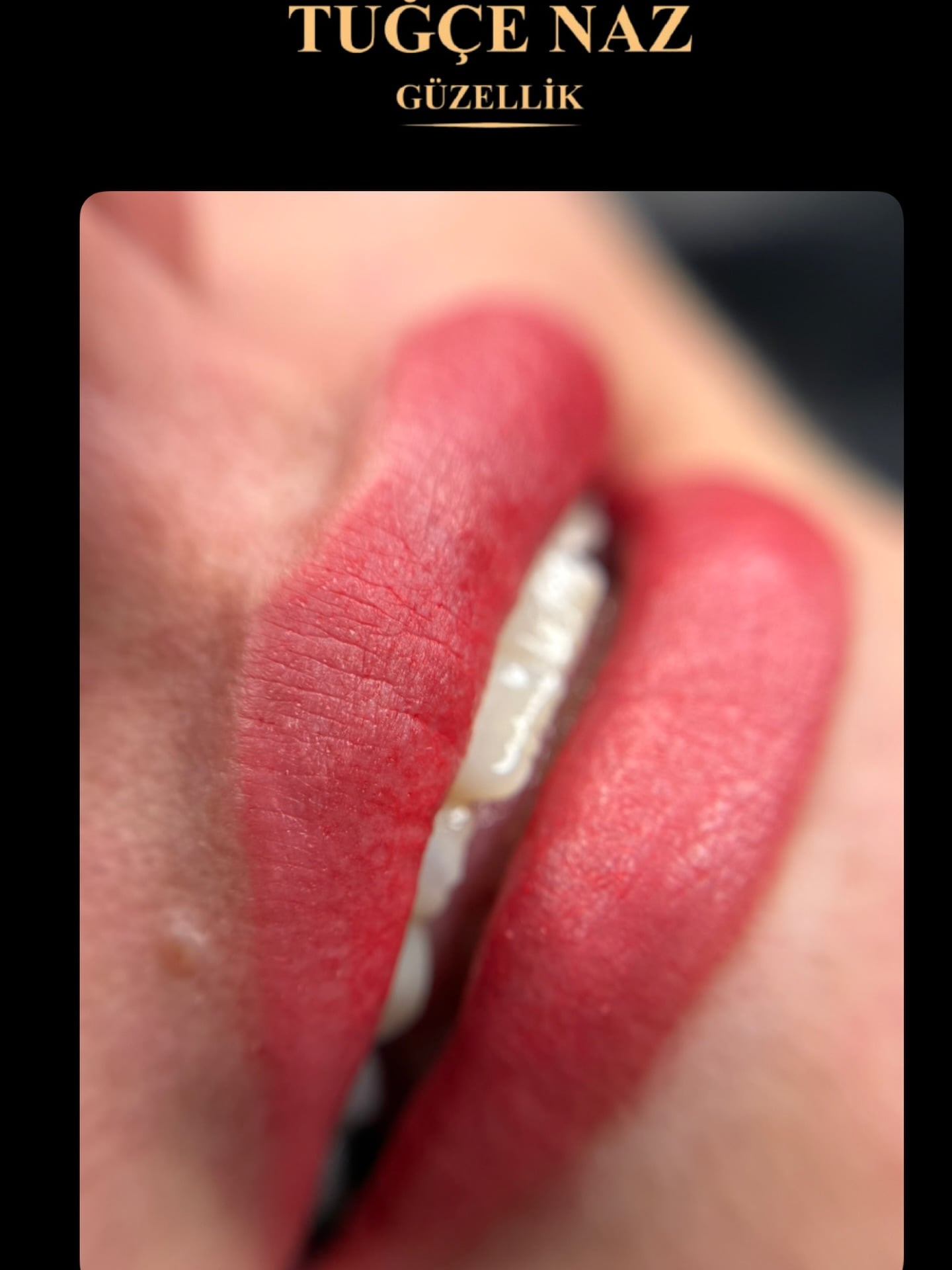 Permanent Lips in Antalya (Lip Blush): The Secret of Natural Pink Tone