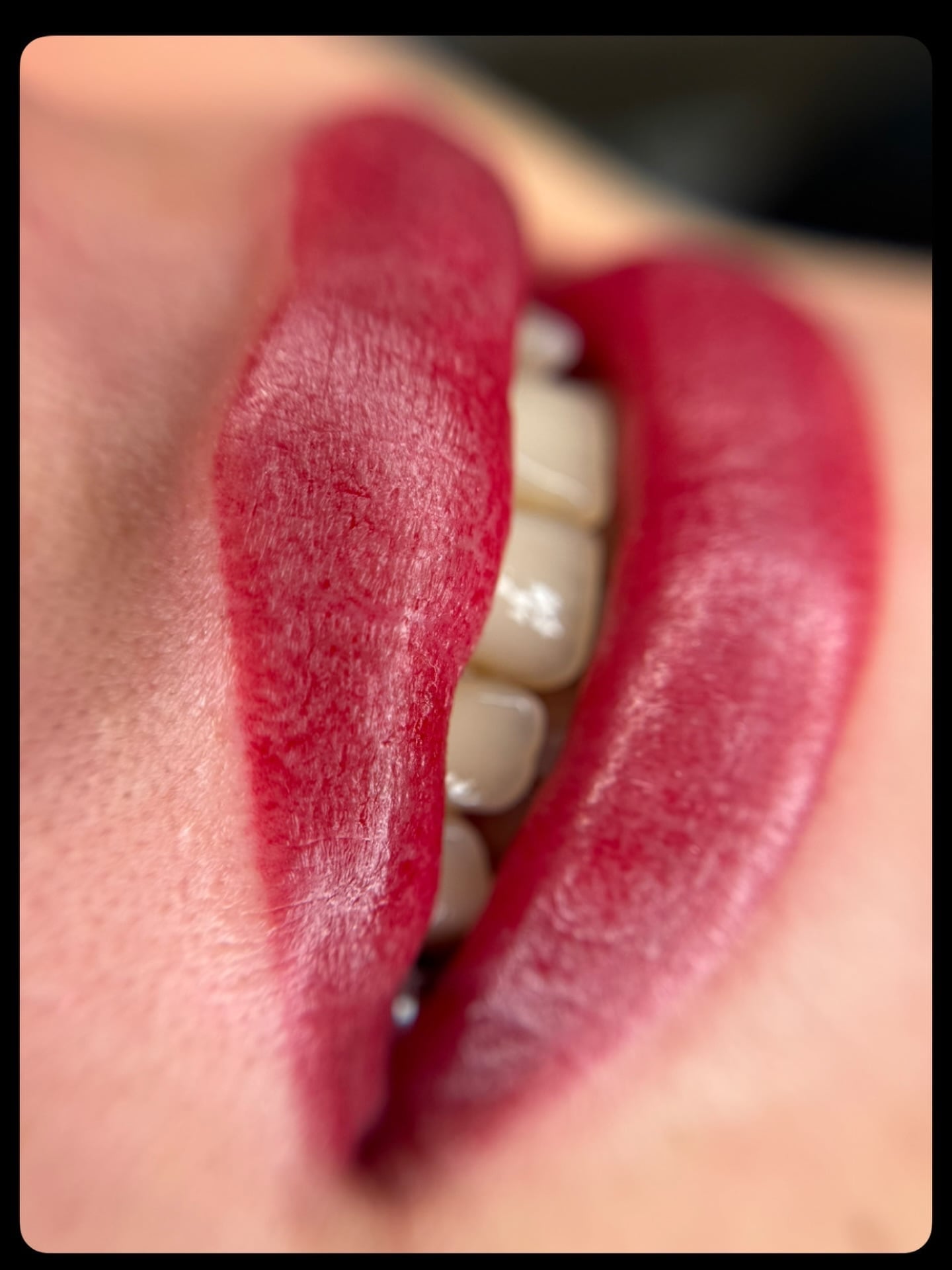 Doğal pembe ton kalıcı dudak uygulaması ❤️ Lip blush tekniği ile ilk seans sonucu. Detaylı bilgi için DM!