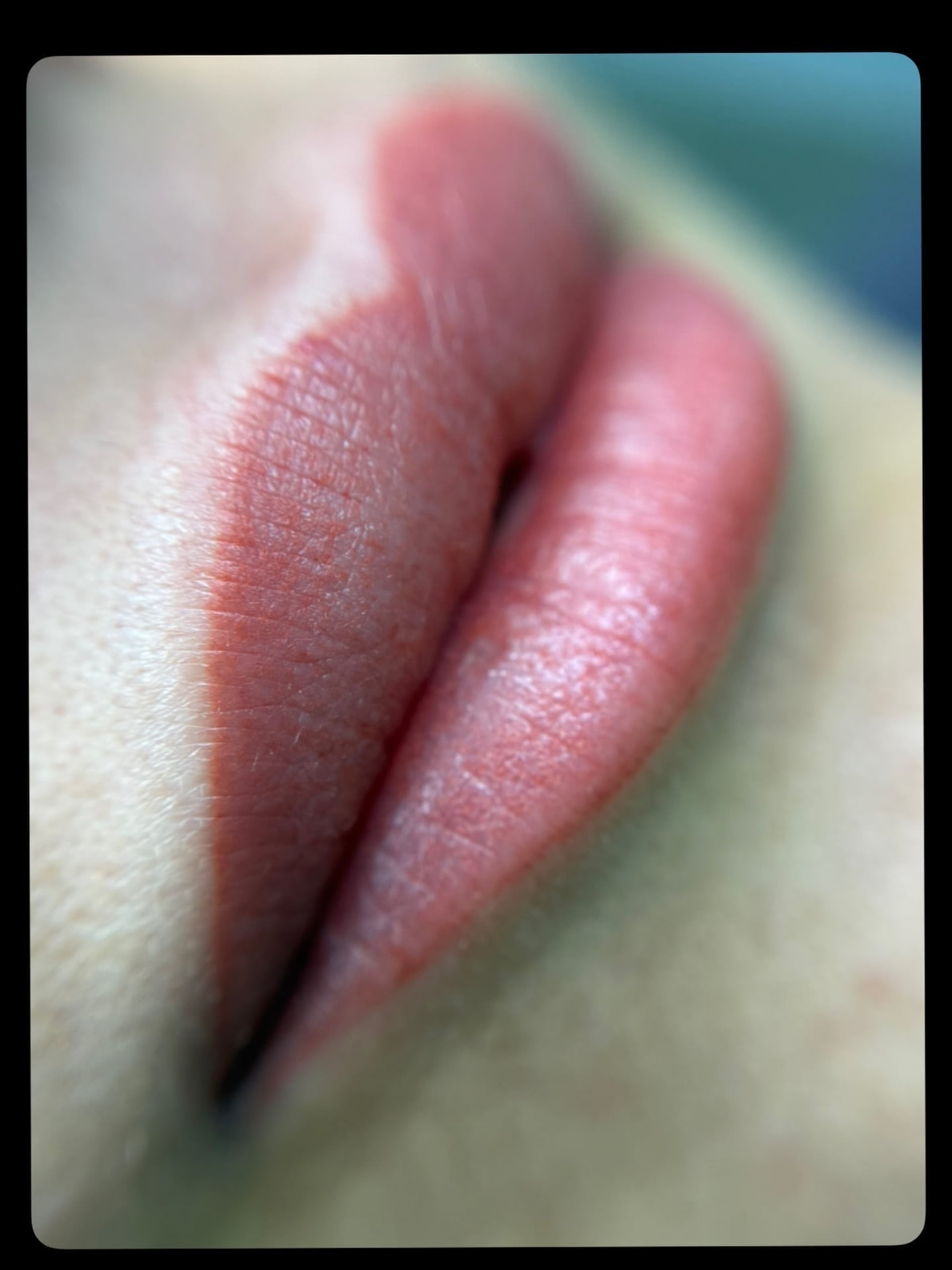Lip blush — sağlıklı pembe ton sonucu 💋 İyileşme süreci özel bakımla geçer.